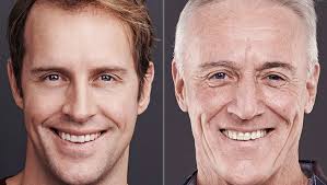 Age-related Face Changes in Men and Wrinkles: How to Prevent