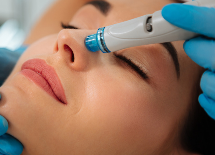 Hydrafacial Leicester: My Journey to Acne-Free Skin