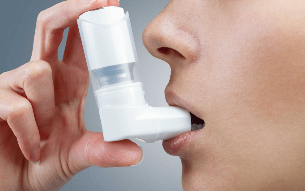 Asthma.
