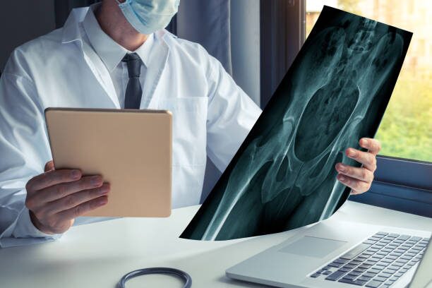 Precision in Motion: The Role of a Hip Surgeon in Your Well-being