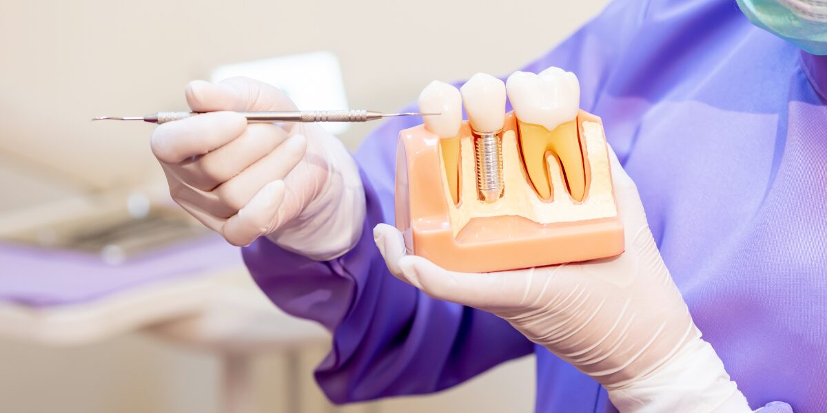 Restorative Dentistry in Montclair
