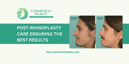 Post-Rhinoplasty Care: Ensuring the Best Results    