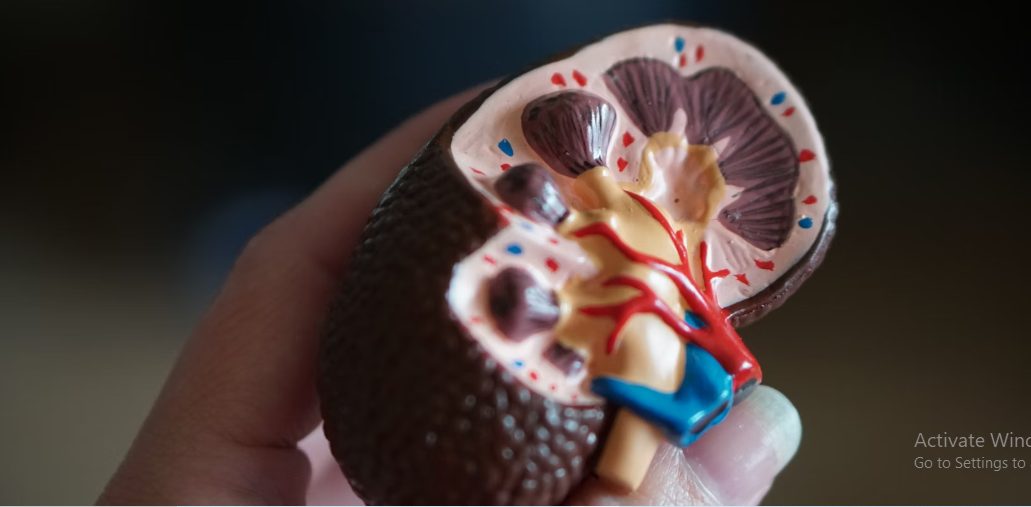 5 Symptoms of Kidney Problems and What to Do about it