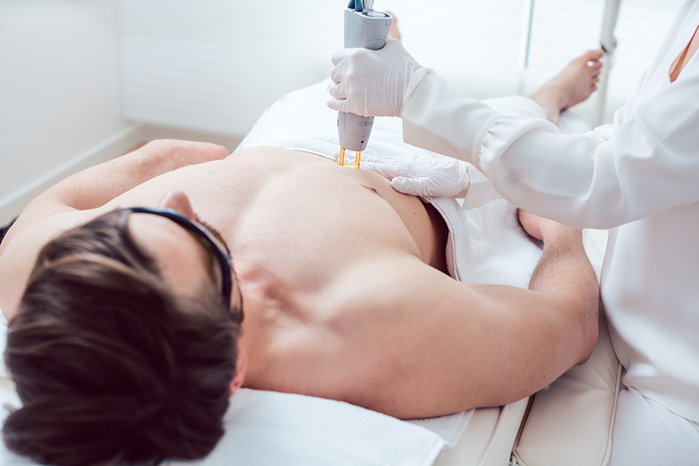How Painful Is Electrolysis Vs Laser Hair Removal?