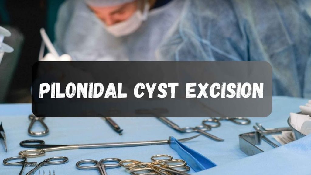A New Beginning: Pilonidal Cyst Excision and Recovery 1 A New Beginning: Pilonidal Cyst Excision and Recovery